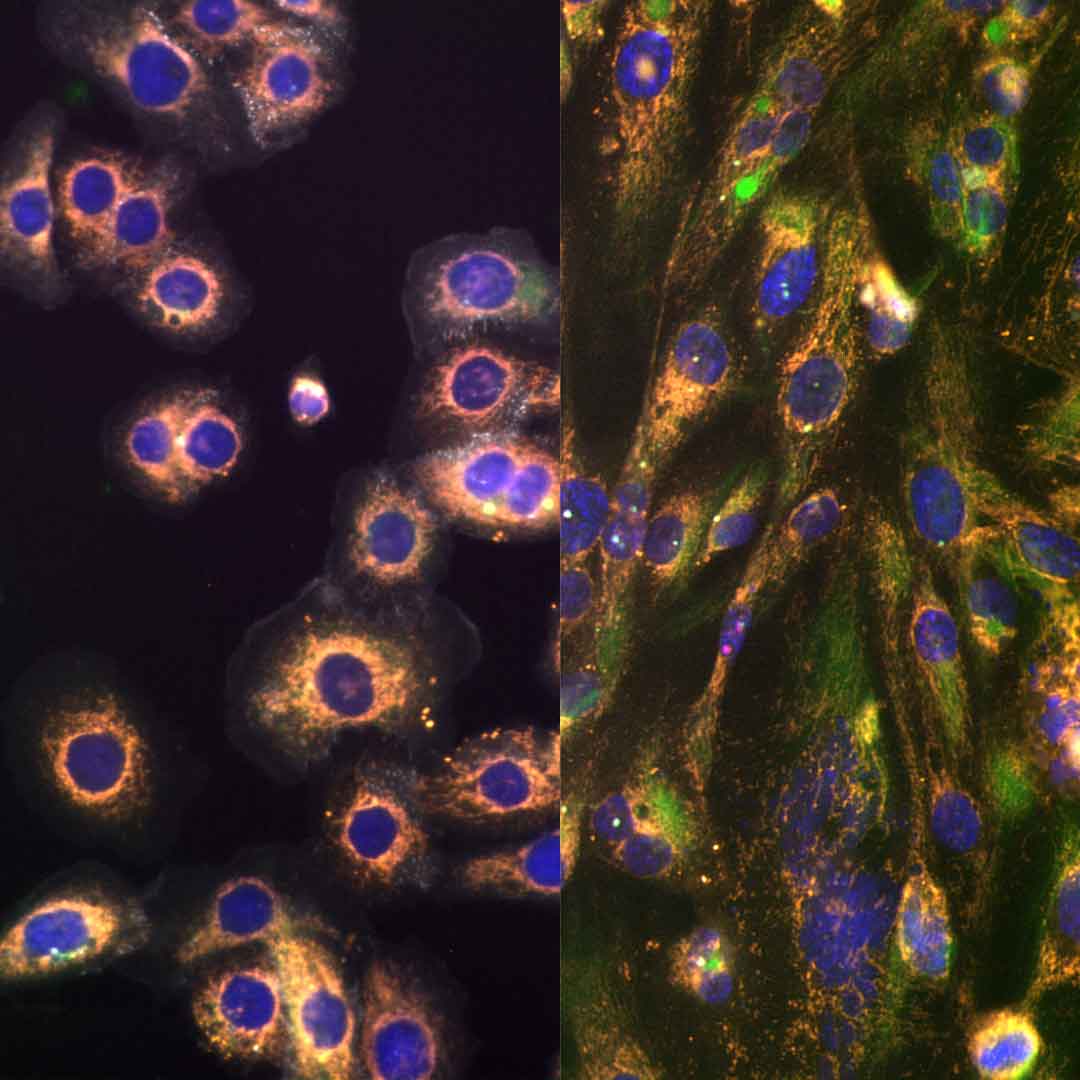 shades-of-metastasis